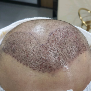 发际线分享社区