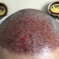 發(fā)際線用戶圖片