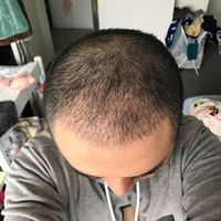 發(fā)際線用戶圖片