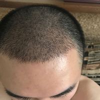 發(fā)際線用戶圖片
