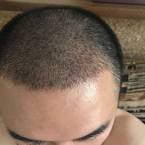 发际线分享社区