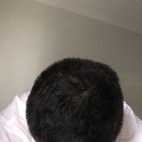 發(fā)際線用戶圖片