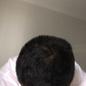 发际线分享社区