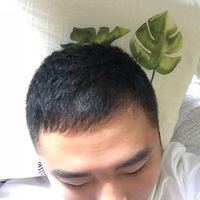 發(fā)際線用戶圖片