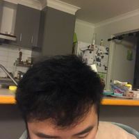 發(fā)際線用戶圖片