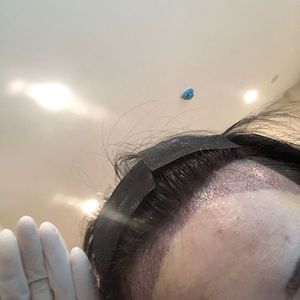 发际线分享社区