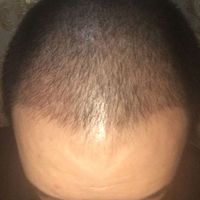 發(fā)際線用戶圖片
