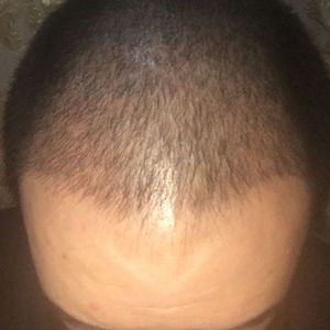 发际线分享社区