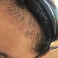 發(fā)際線用戶圖片
