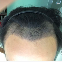 發(fā)際線用戶圖片