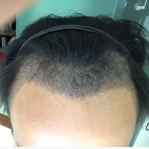 发际线分享社区