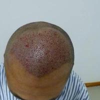 發(fā)際線用戶圖片