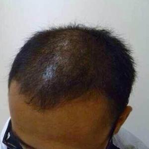 发际线分享社区