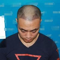 發(fā)際線用戶圖片