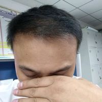 發(fā)際線用戶圖片