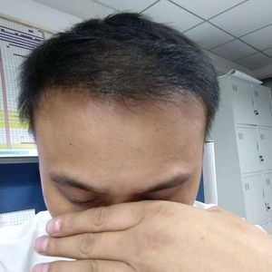 发际线分享社区