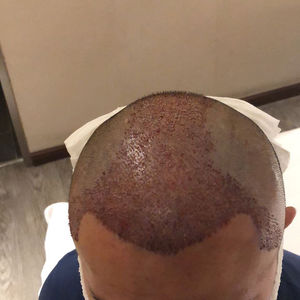 发际线分享社区