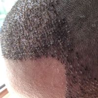 發(fā)際線用戶圖片