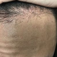 發(fā)際線用戶圖片