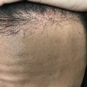 发际线分享社区
