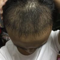 發(fā)際線用戶圖片