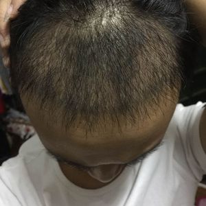 发际线分享社区
