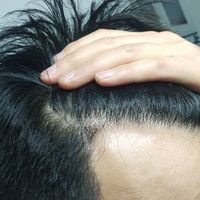 發(fā)際線用戶圖片