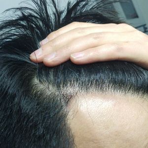 发际线分享社区