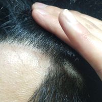 發(fā)際線用戶圖片