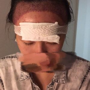 发际线分享社区