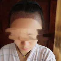 發(fā)際線用戶圖片