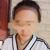 發(fā)際線用戶圖片