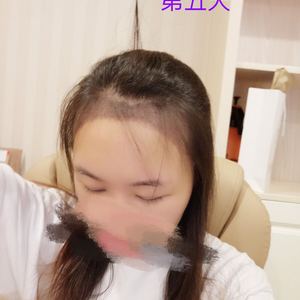 发际线分享社区
