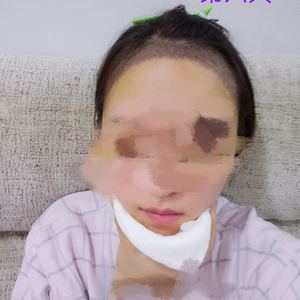 发际线分享社区