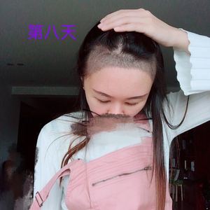 发际线分享社区