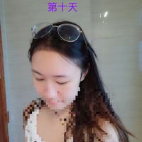 發(fā)際線用戶圖片