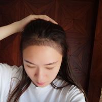 發(fā)際線用戶圖片
