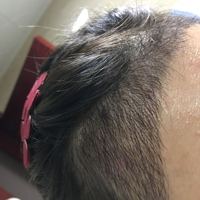 發(fā)際線用戶圖片