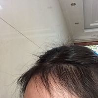 發(fā)際線用戶圖片