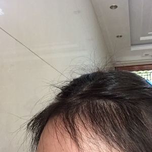 发际线分享社区