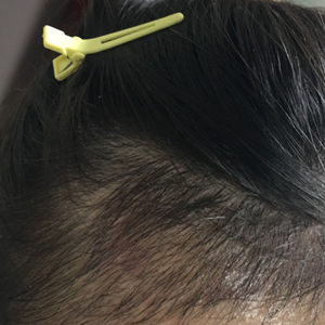 发际线分享社区