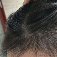 發(fā)際線用戶圖片