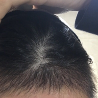 發(fā)際線用戶圖片