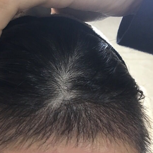 发际线分享社区