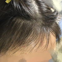 發(fā)際線用戶(hù)圖片