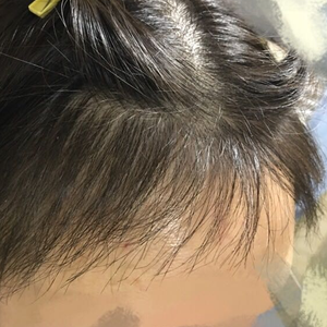 发际线分享社区