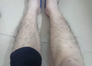 腿毛种植手术原理是什么 腿毛种植有什么好处