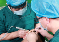 毛囊移植手术的原理是什么 毛囊移植手术好不好