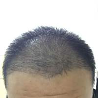 發(fā)際線用戶(hù)圖片