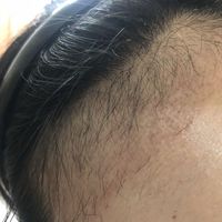 發(fā)際線用戶(hù)圖片